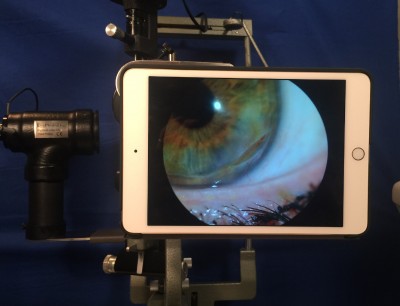 EyePhotoDoc on iPad air2